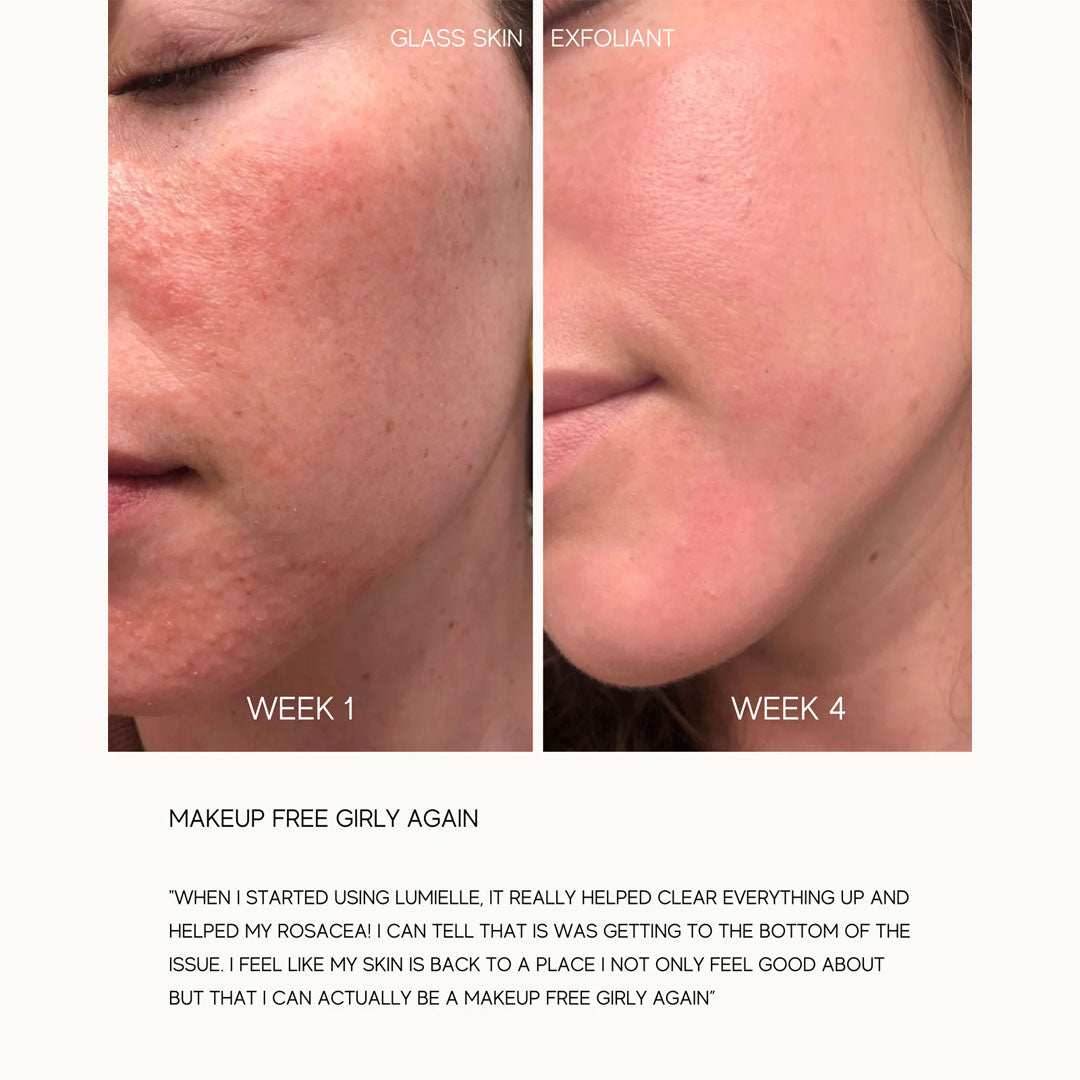 Glass Skin Liquid Exfoliant-cleansers & exfoliators-Lumiellé-HD Skin Dallas