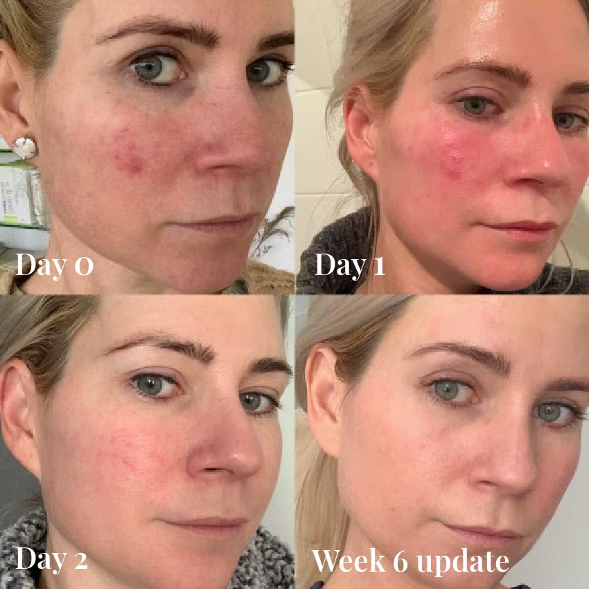 Omnilux Contour Face-Tools-Omnilux-HD Skin Dallas