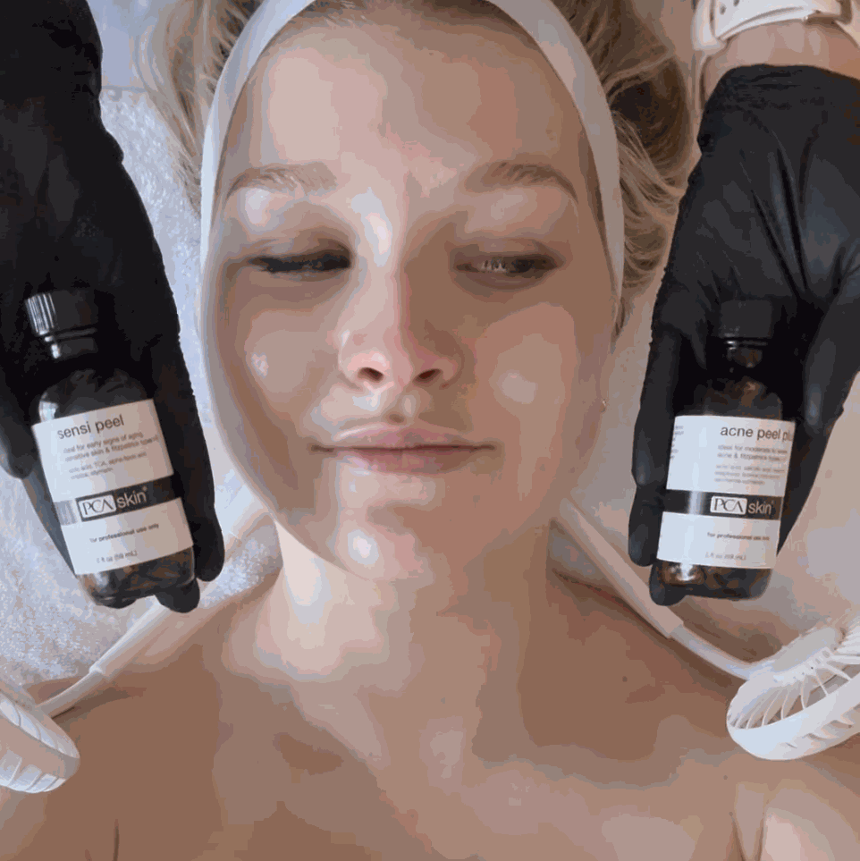 Corrective peels professional skincare treatment"