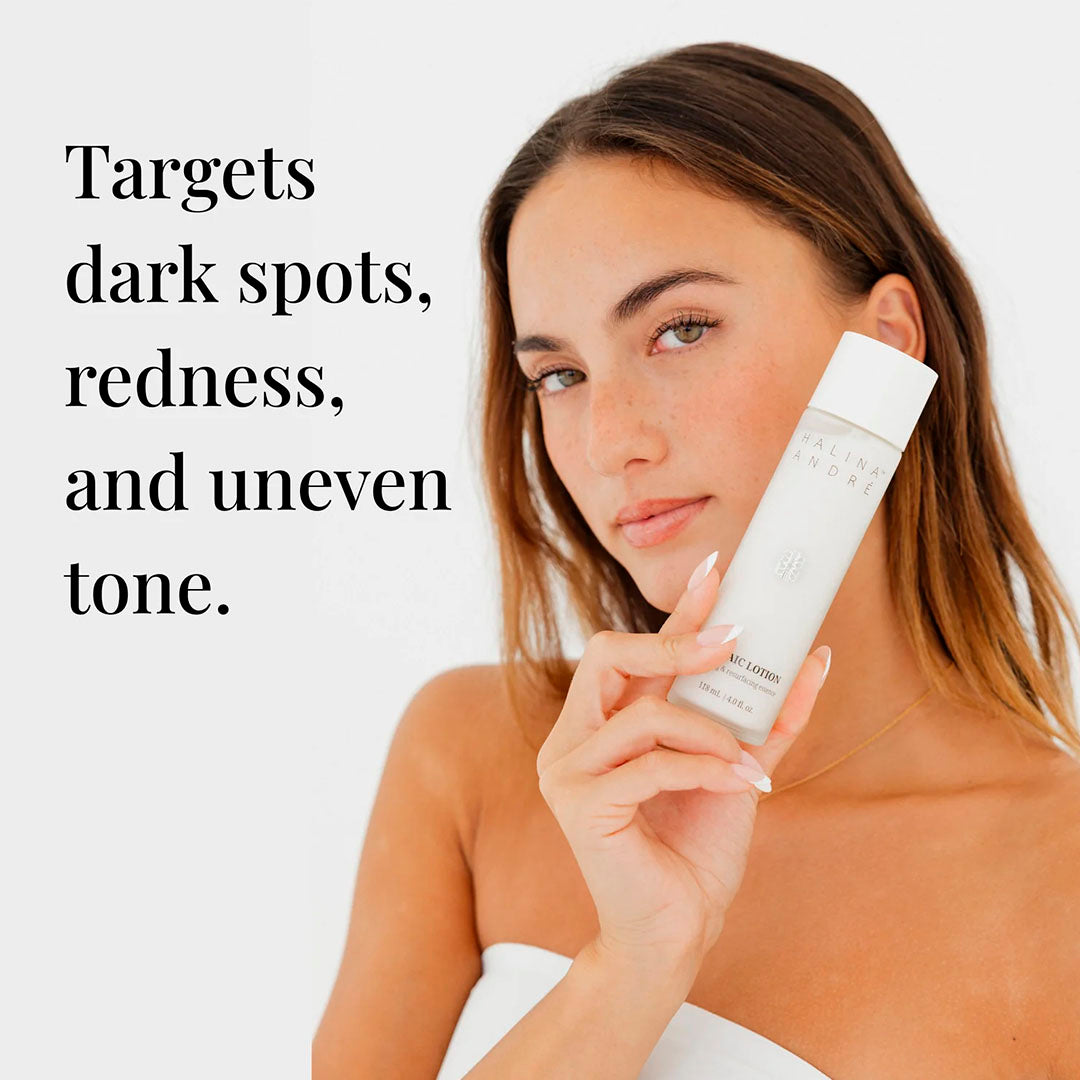 Azelaic Lotion