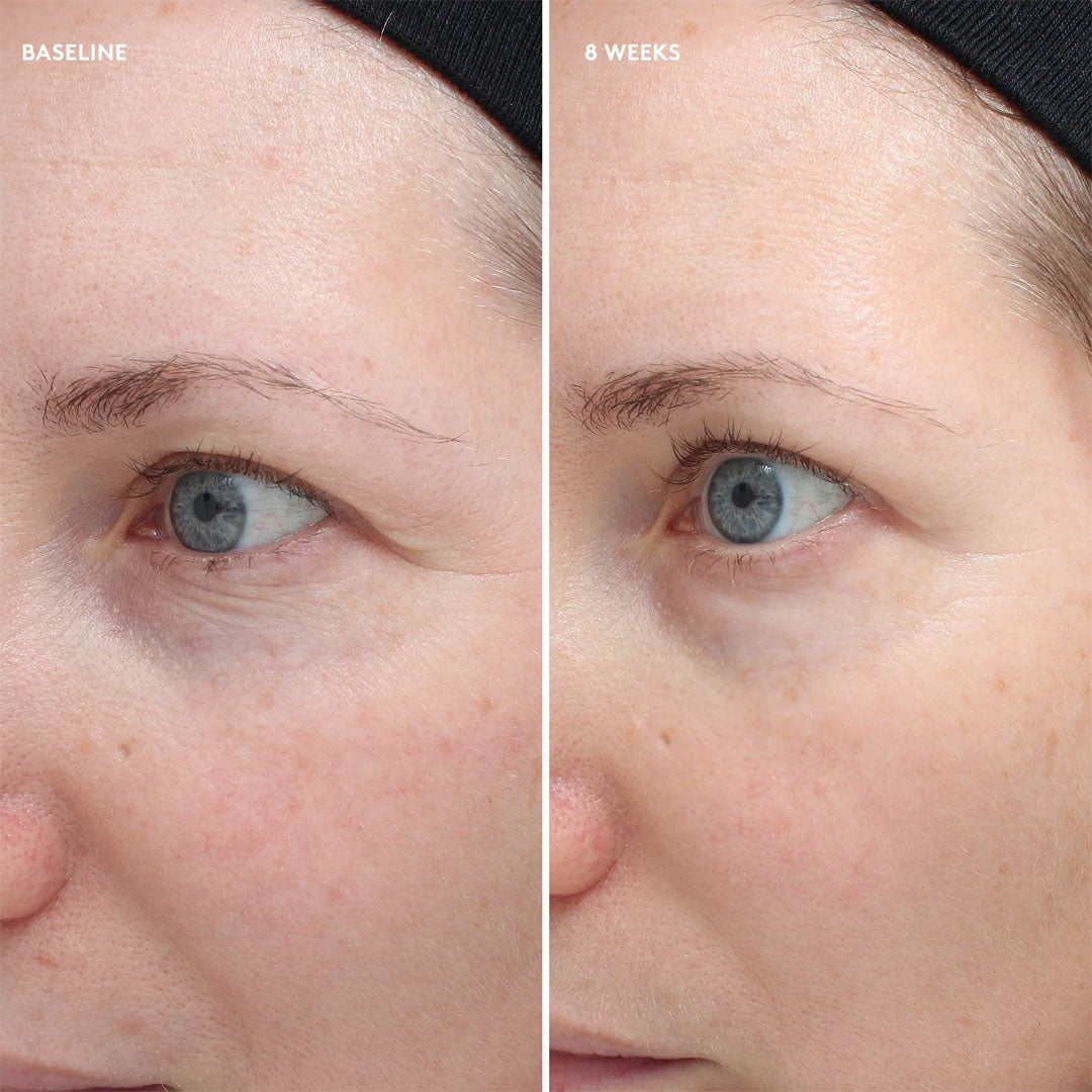 Total Eye® Firm & Repair Cream 8 week results