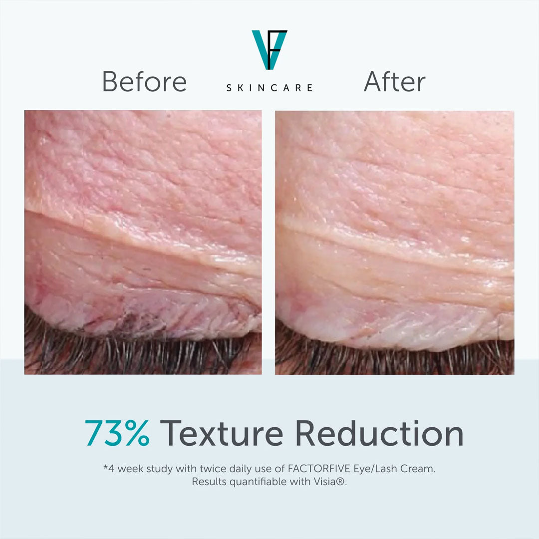 Eye/Lash Cream-eye cream & treatments-FactorFive-HD Skin Dallas