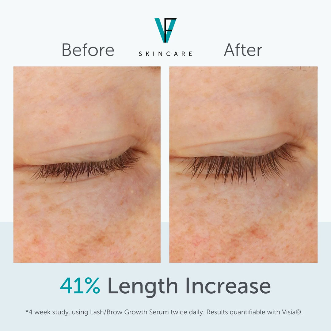 Lash and Brow Growth Serum